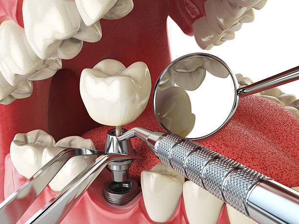 Best Emergency Dental Surgery in Rolling Fork, MS